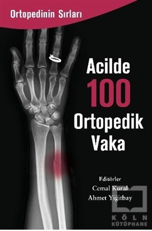 Cemal KuralDiğerAcilde 100 Ortopedik Vaka